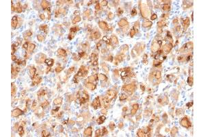 Formalin-fixed, paraffin-embedded human Thyroid stained with Thyroglobulin Mouse Recombinant Monoclonal Antibody (r2H11). (Recombinant Thyroglobulin 抗体)