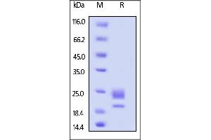 Mouse OX40 Ligand, His Tag on  under reducing (R) condition. (TNFSF4 Protein (AA 49-198) (His tag))