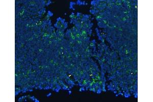anti-Integrin beta 2 (ITGB2) (AA 404-769) antibody
