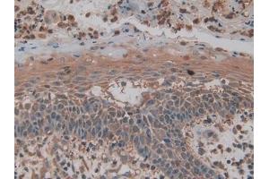 Immunohistochemistry (IHC) image for anti-Pyruvate Kinase M2 (PKM2) (AA 141-248) antibody (ABIN7432133)