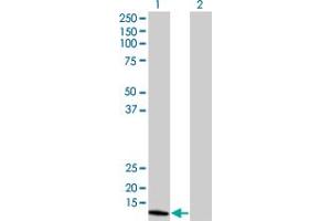 Western Blot analysis of NUDT1 expression in transfected 293T cell line by NUDT1 monoclonal antibody (M02), clone 5F11. (NUDT1 抗体  (AA 1-179))