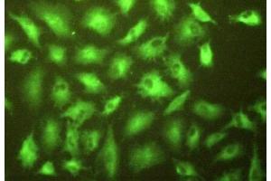 Detection of gGT1 in A549 cells using Polyclonal Antibody to Gamma-Glutamyltransferase 1 (gGT1) (GGT1 抗体  (AA 296-537))