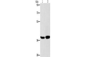 Gel: 8 % SDS-PAGE, Lysate: 40 μg, Lane 1-2: Human fetal brain tissue, 231 cells, Primary antibody: ABIN7128713(CAB39L Antibody) at dilution 1/400, Secondary antibody: Goat anti rabbit IgG at 1/8000 dilution, Exposure time: 15 seconds (CAB39L 抗体)