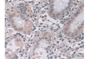 Immunohistochemistry (IHC) image for anti-Proteasome Subunit alpha 5 (PSMA5) (AA 1-241) antibody (ABIN7441322)
