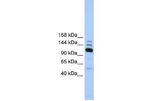 POLR3B antibody used at 1 ug/ml to detect target protein. (POLR3B 抗体  (C-Term))