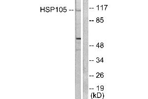 Western blot analysis of extracts from HeLa cells, using HSP105 antibody (#C0231). (HSPH1 抗体)