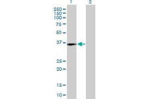 Western Blotting (WB) image for anti-Prostaglandin E Receptor 3 (Subtype EP3) (PTGER3) (AA 1-388) antibody (ABIN519448)