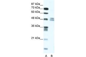 WB Suggested Anti-TRIAntibody Titration:  5. (TRIP13 抗体  (N-Term))