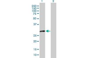 Western Blot analysis of MMS19 expression in transfected 293T cell line by MMS19 MaxPab polyclonal antibody. (MMS19 抗体  (AA 1-293))