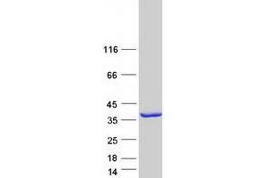 Validation with Western Blot