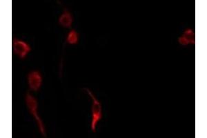 ABIN6275691 staining K562 by IF/ICC. (ZNF420 抗体  (Internal Region))