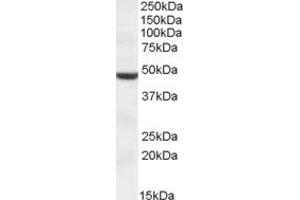 Image no. 1 for anti-Transmembrane Protease, serine 4 (TMPRSS4) (AA 243-255) antibody (ABIN490516) (TMPRSS4 抗体  (AA 243-255))
