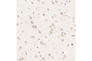 Immunohistochemistry analysis of paraffin embedded rat brain using ZNF771 (ABIN7076273) at dilution of 1: 600 (ZNF771 抗体)