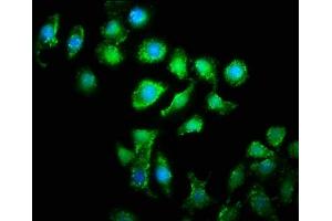 Immunofluorescence staining of A549 cells with ABIN7166328 at 1:133, counter-stained with DAPI. (WWC2 抗体  (AA 828-1127))