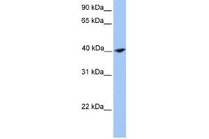 WB Suggested Anti-CNN2 Antibody Titration: 0. (CNN2 抗体  (N-Term))