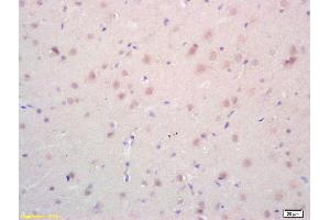 Formalin-fixed and paraffin embedded rat brain labeled with Rabbit Anti phospho-Androgen Receptor(Ser578) Polyclonal Antibody, Unconjugated (ABIN730123) at 1:200 followed by conjugation to the secondary antibody and DAB staining (Androgen Receptor 抗体  (pSer578))