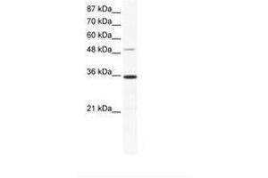 Image no. 1 for anti-Zinc Finger Protein 610 (ZNF610) (AA 70-119) antibody (ABIN6736026) (ZNF610 抗体  (AA 70-119))