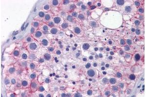 Human Testis: Formalin-Fixed, Paraffin-Embedded (FFPE) (TJP1 抗体  (AA 935-984))