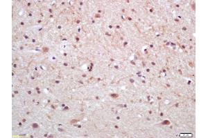 Formalin-fixed and paraffin embedded rat brain labeled with Anti Prostatic Acid Phosphatase Polyclonal Antibody (ABIN716996), Unconjugated at 1:200, followed by conjugation to the secondary antibody and DAB staining