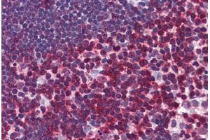 Human Thymus: Formalin-Fixed, Paraffin-Embedded (FFPE) (CD247 抗体  (AA 1-165))
