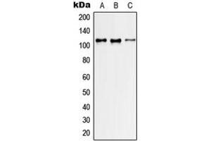 Western blot analysis of GEF H1 expression in HeLa (A), NIH3T3 (B), H9C2 (C) whole cell lysates. (ARHGEF2 抗体  (Center))
