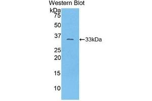 Detection of Recombinant COL1a1, Mouse using Polyclonal Antibody to Collagen Type I Alpha 1 (COL1a1) (COL1A1 抗体  (AA 1225-1453))