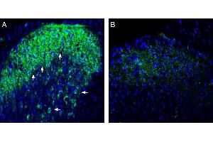 Expression of Connexin-47 in rat spinal cord dorsal horn region. (GJC2 抗体  (AA 100-111))