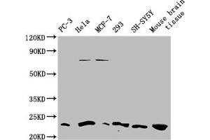 Western blot All lanes: TMEM65 antibody at 1. (TMEM65 抗体  (AA 63-240))