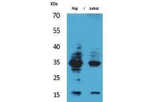 Western Blotting (WB) image for anti-Interleukin 4 (IL4) (Internal Region) antibody (ABIN3187690) (IL-4 抗体  (Internal Region))