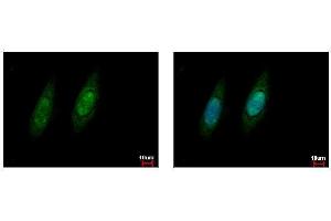 ICC/IF Image VCP antibody detects VCP protein at cytoplasm and nucleus by immunofluorescent analysis. (VCP 抗体  (C-Term))
