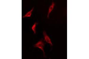 ABIN6278569 staining  HepG2 cells by IF/ICC. (FAF1 抗体  (C-Term))