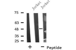 Western blot analysis of extracts from Jurkat cells, using BRE antibody. (BRE 抗体  (C-Term))