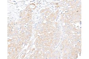 Immunohistochemistry (IHC) image for anti-Vinculin (VCL) (AA 1016-1066) antibody (ABIN7454836) (Vinculin 抗体  (AA 1016-1066))