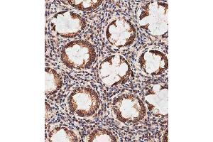 Immunohistochemical analysis of E on paraffin-embedded human colon tissue was performed on the Leica®BOND RXm.