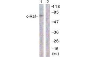 Western blot analysis of extracts from 293 cells, treated with PMA 125ng/ml 30' , using C-RAF (Ab-296) Antibody. (RAF1 抗体  (AA 271-320))