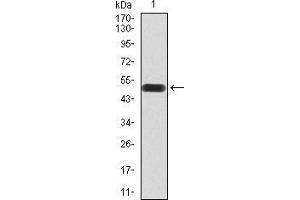 Western blot analysis using Rab3a mAb against human Rab3a (AA: 1-220) recombinant protein. (RAB3A 抗体  (AA 1-220))