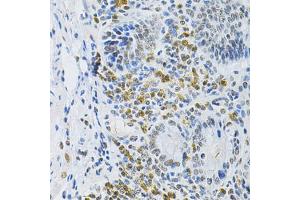 Immunohistochemistry of paraffin-embedded mouse stomach using SMARCE1 Antibody (ABIN5973097) at dilution of 1/200 (40x lens).
