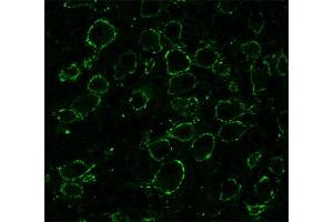 Presynaptic immunostaining of the calyx of Held in the medial nucleus of the trapezoid body (MNTB; dilution 1 : 1000). (SNAP91 抗体  (AA 279-297))
