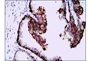 Immunohistochemistry (IHC) image for anti-Hyaluronan Synthase 3 (HAS3) antibody (ABIN1845757) (HAS3 抗体)