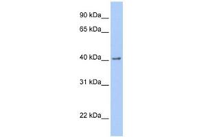 WB Suggested Anti-GFRA2 Antibody Titration: 0. (GFRA2 抗体  (C-Term))