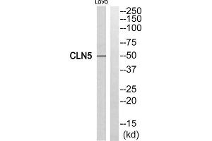 Western blot analysis of extracts from LOVO cells, using CLN5 antibody. (CLN5 抗体  (Internal Region))
