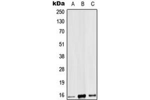Western blot analysis of IL-9 expression in HEK293T (A), mouse heart (B), rat heart (C) whole cell lysates. (IL-9 抗体  (Center))