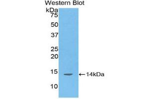 Western blot analysis of the recombinant protein. (DDO 抗体  (AA 117-199))