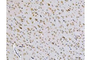 IHC analysis of EIF3A using anti-EIF3A antibody (ABIN7599942). (EIF3A 抗体  (AA 13-477))