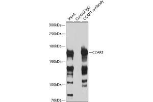 Immunoprecipitation analysis of 200 μg extracts of HeLa cells using 3 μg CC antibody (ABIN6129224, ABIN6138030, ABIN6138032 and ABIN6217655). (CCAR1 抗体  (AA 1-200))