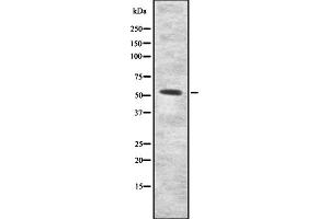 Western blot analysis of INAR2 expression in HEK293 cells ,The lane on the left is treated with the antigen-specific peptide. (IFNAR2 抗体  (C-Term))