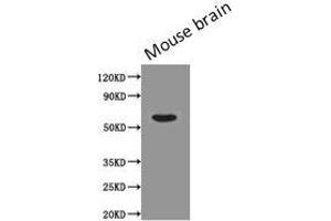 Western Blot Positive WB detected in: Mouse brain tissue All lanes: PODXL antibody at 0. (PODXL 抗体)