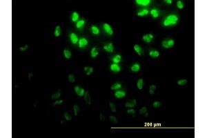 Immunofluorescence of monoclonal antibody to DPH2 on HeLa cell. (DPH2 抗体  (AA 125-235))