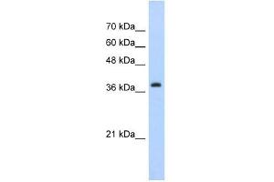 Western Blot showing CBX6 antibody used at a concentration of 1-2 ug/ml to detect its target protein. (CBX6 抗体  (C-Term))