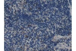 Detection of IL2 in Mouse Spleen Tissue using Monoclonal Antibody to Interleukin 2 (IL2) (IL-2 抗体  (AA 10-169))
